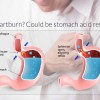 what-causes-heartburn