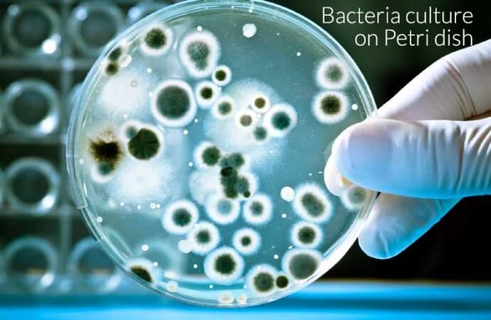 What is bacteria?
